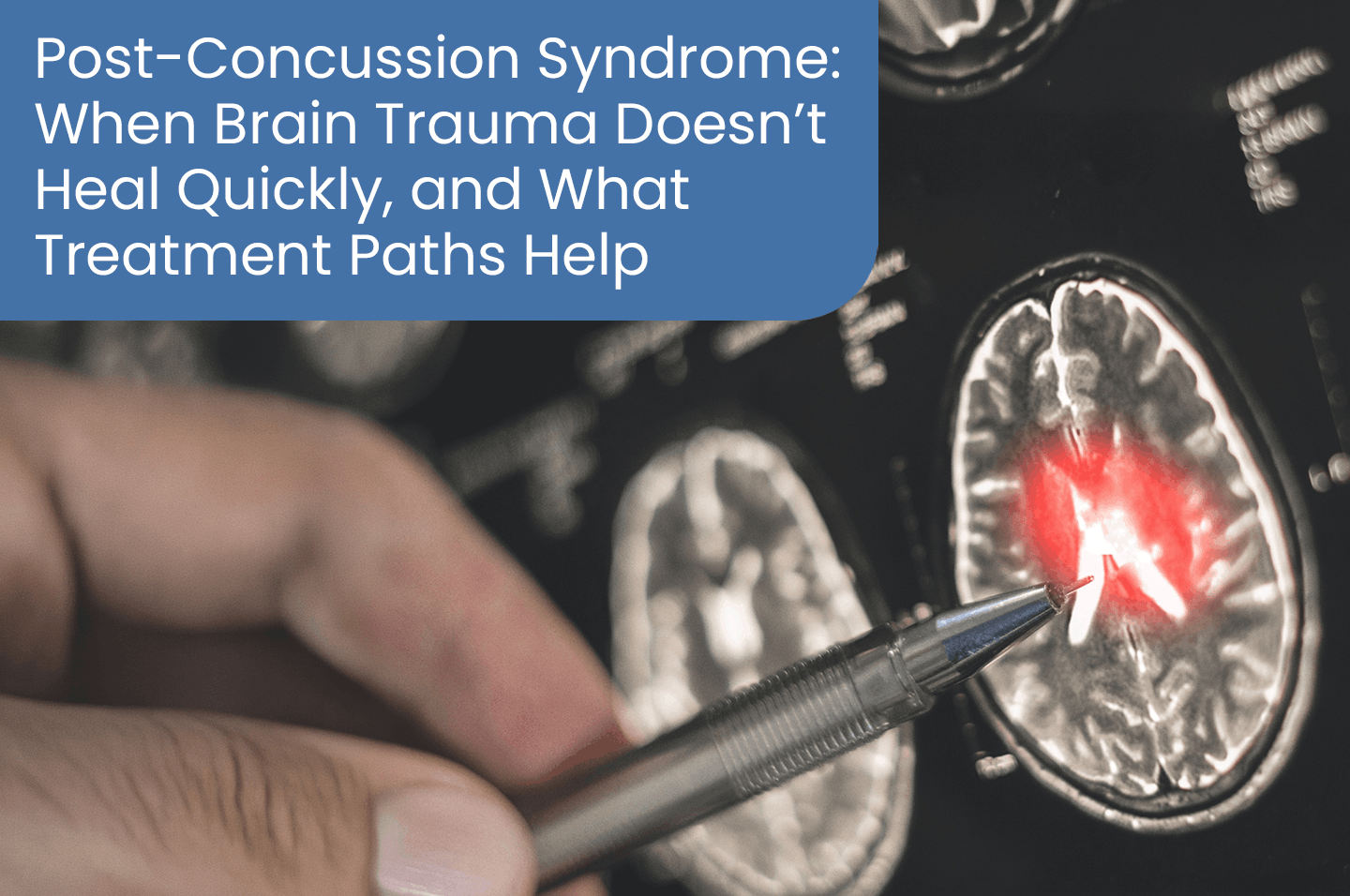 Post-concussion syndrome: When brain trauma doesn’t heal quickly, and what treatment paths help